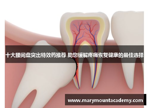 十大腰间盘突出特效药推荐 助您缓解疼痛恢复健康的最佳选择